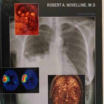 Squire’s Fundamentals of Radiology: Sixth Edition