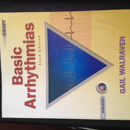 Basic Arrhythmias
