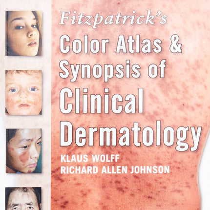 Fitzpatrick's Color Atlas and Synopsis of Clinical Dermatology: Sixth Edition